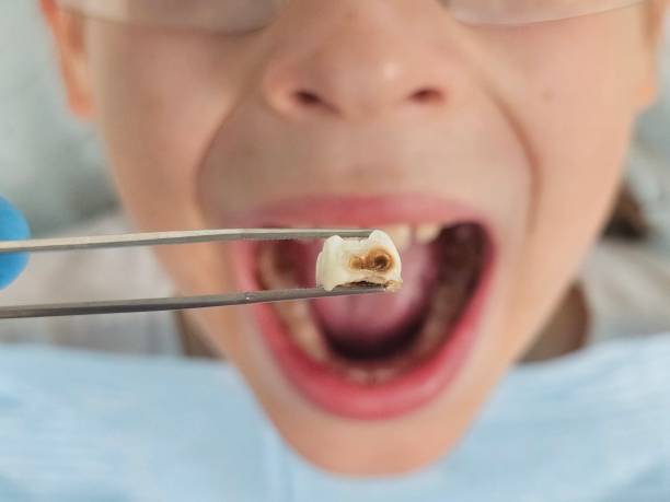 Best Weekend Emergency Dentist in Buena Vista, VA